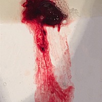 怀孕二个多月，今天突然腹部隐隐作痛，排出了一个大血块，请问这是孕囊吗，好害怕……