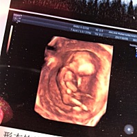 三个月，能看出来男孩女孩吗？