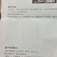 宝妈们NT2.2正常吗？医生说有点高我很担心