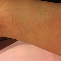 每天晚上都这样折腾我，怎么办呢？现在才六七周左右。有知道怎么回事的朋友吗？见照片。