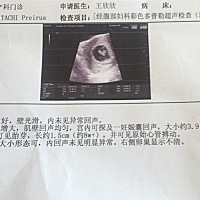 是男是女能看的出来吗？