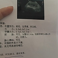 看得出来是男宝还是女宝吗？