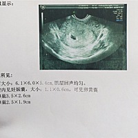 是男宝还是女宝？