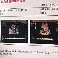 13周零6天、NT过啦、早唐也过啦、放心多了、不会看男孩女孩、不过不管怎样、妈妈爱你、看你发育健全特别...
