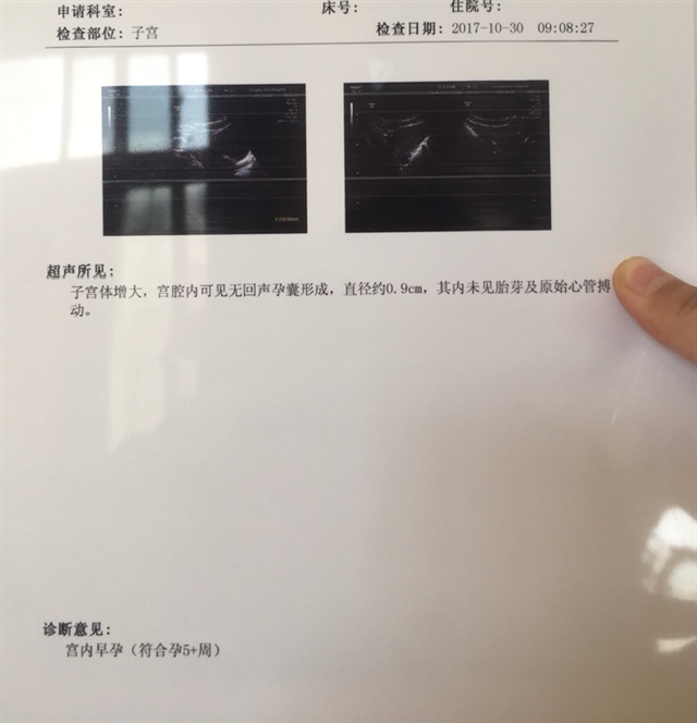 昨天见红，现在有褐色，孕囊无回声又是zahui