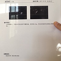 刚做的b超 有懂的吗 帮我看看