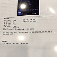 大家帮我看看 是女孩还是男孩？^_^