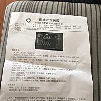 谁看得出来最新的彩超，后天要生了