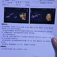 各位宝妈帮忙看下宝宝是男孩还是女孩啊？