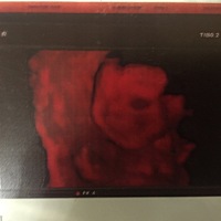 有懂的帮我看看男孩女孩？感谢🙏