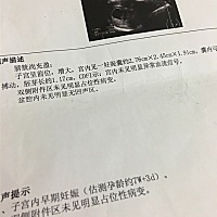 有经验的能看出是男宝还是女宝吗？！