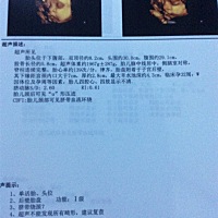 孕32周，哪位宝妈能看出是男是女，好准备衣服，谢谢！