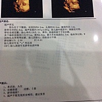 麻烦哪位宝妈帮忙看下是男宝还是女宝，谢谢