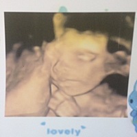 陪老婆一起做的四维，第一次看见宝贝……准备起名字了，怎么看男孩女孩的，大神支招～