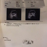 请各位宝妈帮我看看是男孩还是女孩？检查的时候是3个月差4天。