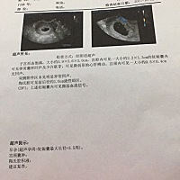 帮忙看看怎么回事？是不是单胎？是不是有胎心了？