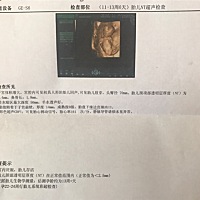 各位有经验的宝马麻烦帮看下是男孩还是女孩，谢谢！