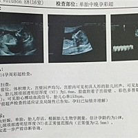 请问是男孩女孩？好奇