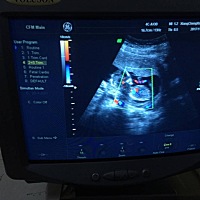 终于看到有点形状的你了，男孩女孩都好，只希望你健健康康的