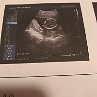 宝妈们，这是男宝还是女宝呢