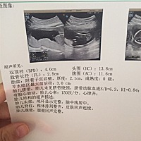 只是很好奇，想知道是女宝宝还是男宝宝，有人知道吗？