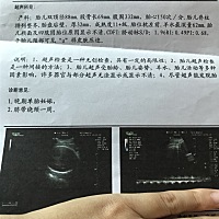 请各位大神帮忙看一下男宝还是女宝