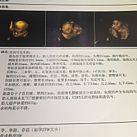 男娃还是女娃呀！