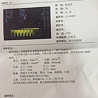 孕妈们有谁会看B超的？帮我看下是男孩还是女孩🙏。