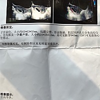 这个可以看出男孩女孩吗