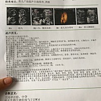 大家帮忙看看像男孩女孩？