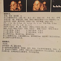 大家帮帮忙看下男孩女孩，看看你们准不准。谢谢啦！