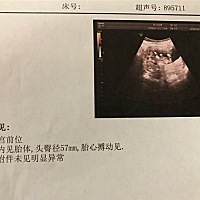 孕12周左右，偶尔会出血症状，量不多，这是彩超检查，医生说没什么问题，但什么会有血呢？要不要紧这样...