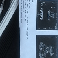 好奇男还是女，但是只要健康都好。