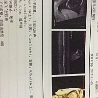 谁能帮忙看下是女孩男孩谢谢