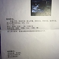 好奇宝宝是男孩还是女孩，有没有懂的人帮忙看一下🤗