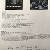 请高手指点 是弟弟还是妹妹  谢谢