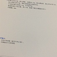 nt虽然通过了。但是看了很多宝妈的nt都控制在1.左右，而我过了2.   有点担心害怕啊。🌑