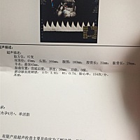 9月25日去做的B超，半个看一下男宝女宝，谢谢