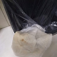 怀孕五周，今天发现有这种情况，严重不？