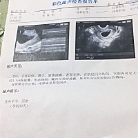 第一次照B超，这个能看出什么？懂得妈妈看下