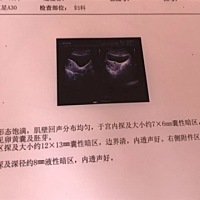 谁知道是男宝还是女宝啊？