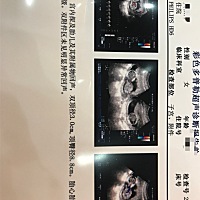 帮忙看下男孩还女孩。谢谢啦