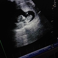 我们老家里医院告诉男孩女孩。看到的猜猜看准不 嘿嘿