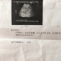 姐妹们帮我看看是男宝还是女宝💓