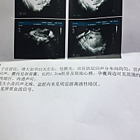 上次去还没胎心，今天去就有了，二胎了比一胎累啊，懂的能帮看下男孩女孩吗