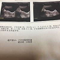 有没有人可以帮我看下，这个严重不。