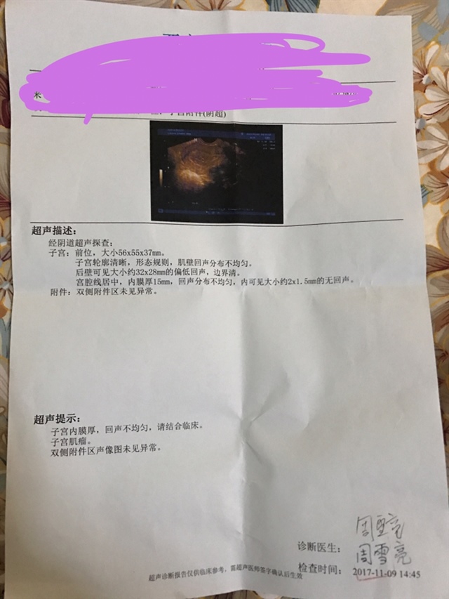 回声区，没出血肚子也不疼，什么情况，danw