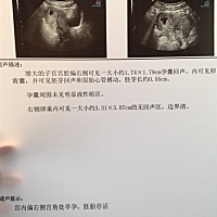 请问有没有类似情况，现在情况是不是特糟糕？   伤心