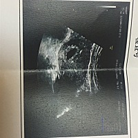 有大神会看男宝女宝的嘛😍