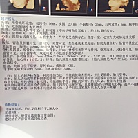 各位宝妈，看男宝还是女宝？